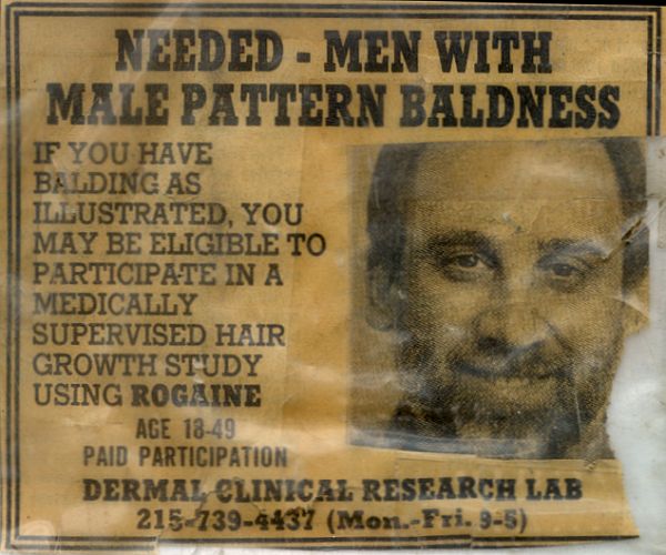 Harvey-Holiday-baldness-ad k028